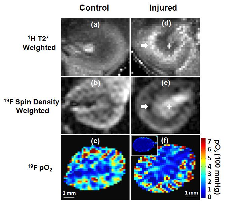 Figure 6.3 Representative 1 H T2*-weighted image, 19 F spin density weighted image and po 2 mapping in contralateral and injured kidneys.