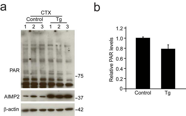 Supplementary Fig. 8 (a) AIMP2 and PAR from the cortex (CTX) of AIMP2 transgenic and littermate control mice (12 month old, n = 3 per group) monitored by western blot.