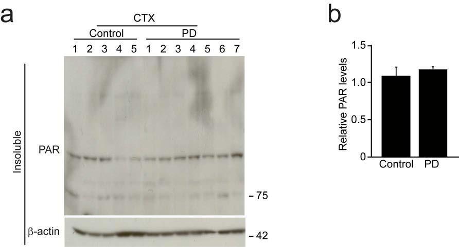 Supplementary Fig. 12 (a) PAR conjugated proteins in the cortex of postmortem brain tissues from PD patients and agematched controls monitored by western blot.