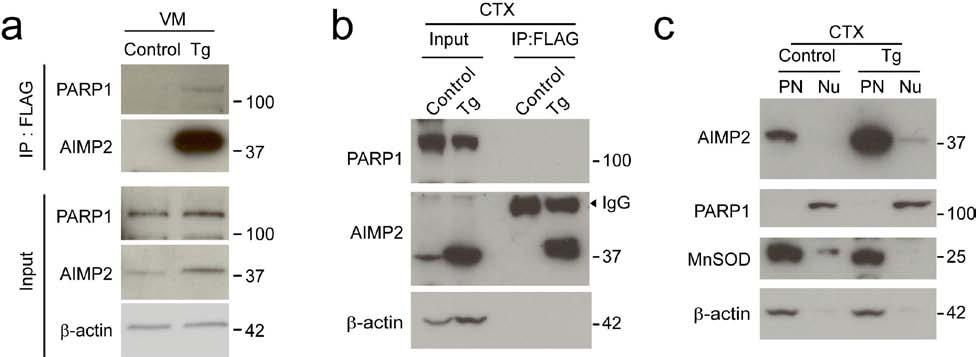 Supplementary Fig. 6 (a) Immunoprecipitation of AIMP2-FLAG from the ventral midbrain (VM) of control and AIMP2 transgenic mice (line 322) monitored by western blot with antibodies to AIMP2 or PARP1.