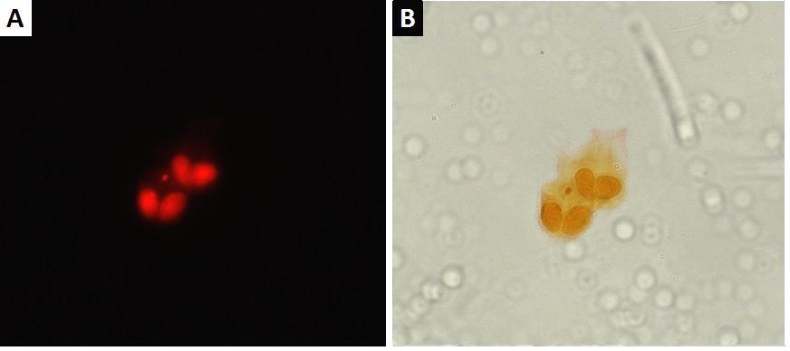 Page 8 of 8 Figure 1: Binucleated cells containing a micronucleus. (A) Fluorescence microscope image of two binucleated cells. One cell contains a micronucleus (white arrow).