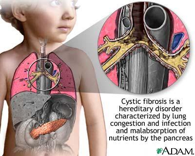 David Form - August 15, 2012 2 Model Organisms Cystic fibrosis is a genetic disorder that affects humans If yeast contain a protein that is related (homologous) to the protein involved in cystic