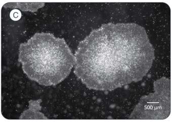 Matrigel in mtesr 1 or TeSR 2 compared to those grown on feeder cells).