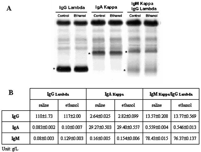 Clinical Chemistry 49, No. 6, 2003 871 Fig. 2. Effects of 100 ml/l ethanol on M-proteins.