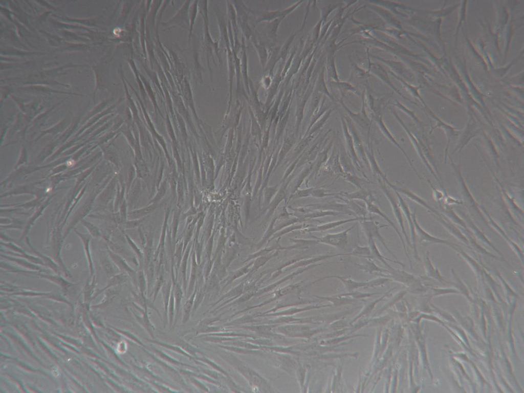 Suspend in cold Dermal Fibroblast Cryopreservation medium (Cat# DFM-100) at a concentration of 1X10 6 cells/ml. Do not exceed a 6:1 ratio of cells (per million): volume freeze medium (per ml). c. Remember to account for the volume of the cell pellet before adding the volume of freeze medium necessary for cell suspension.