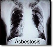 More than 3000 people per year die from asbestos related diseases such as