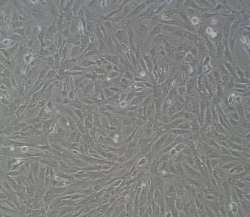ES cell-derived PDGFRα + Mesenchymal stem