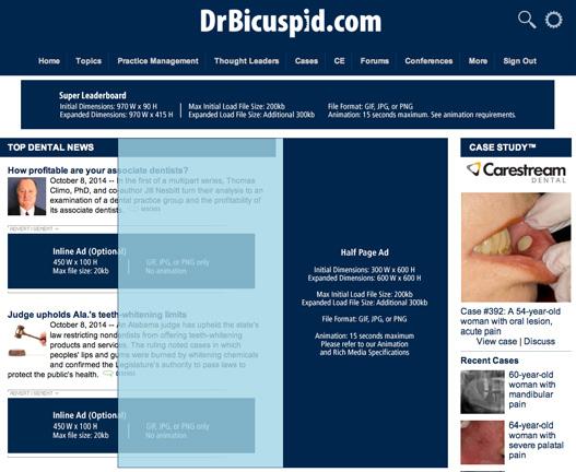 Run-of-Site Banner Ads DrBicuspid s Run-of-Site (ROS) banner ads appear in all sections of the site not exclusively sponsored.