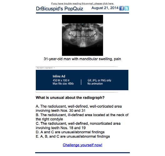 PopQuiz Banner Ad An email version DrBicuspid s popular Case of the Day mailed to opt-in members.