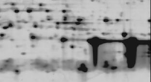 A comparison of the gel images of an untreated plasma sample and a ProteoMiner kit-treated sample revealed the following: 1) spots that appeared in both images were more intense in the gels from the