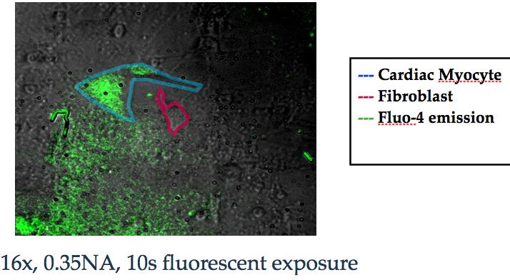 4. RESULTS Experimentation done with a 16x objective allowed us to distinguish between cardiac myocytes and fibroblasts on a relatively overgrown