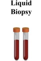 Preanalytics and the Liquid Biopsy Most common analyte assayed in liquid biopsies: cell-free tumor DNA Cancer: detection of mutations Pregnancy: screening for chromosomal disorders Preanalytical