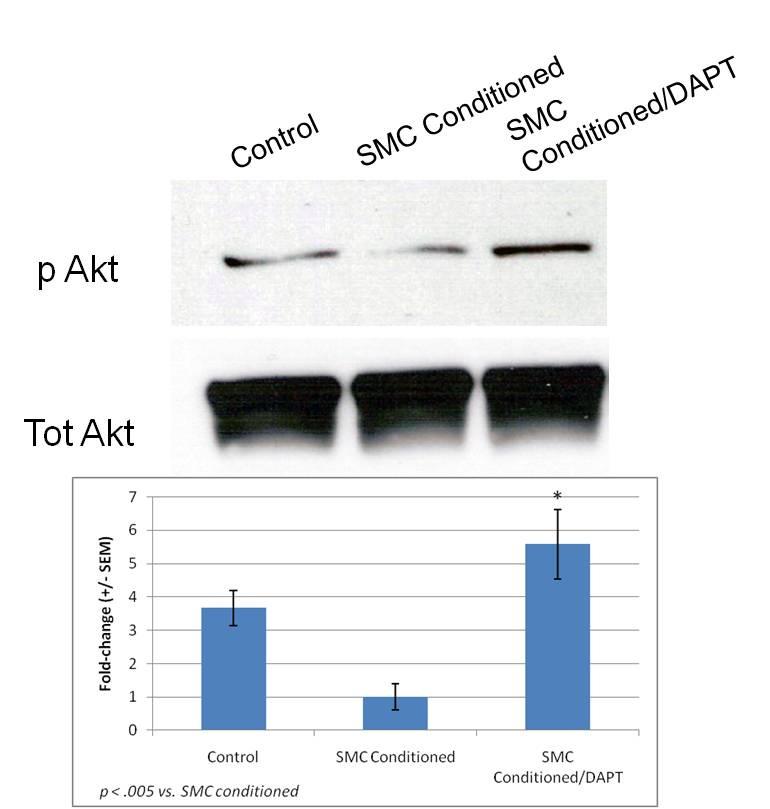 100 Figure 41. Notch inhibition on levels of phosphorylated Akt in ECs stimulated with SMC derived soluble factors.