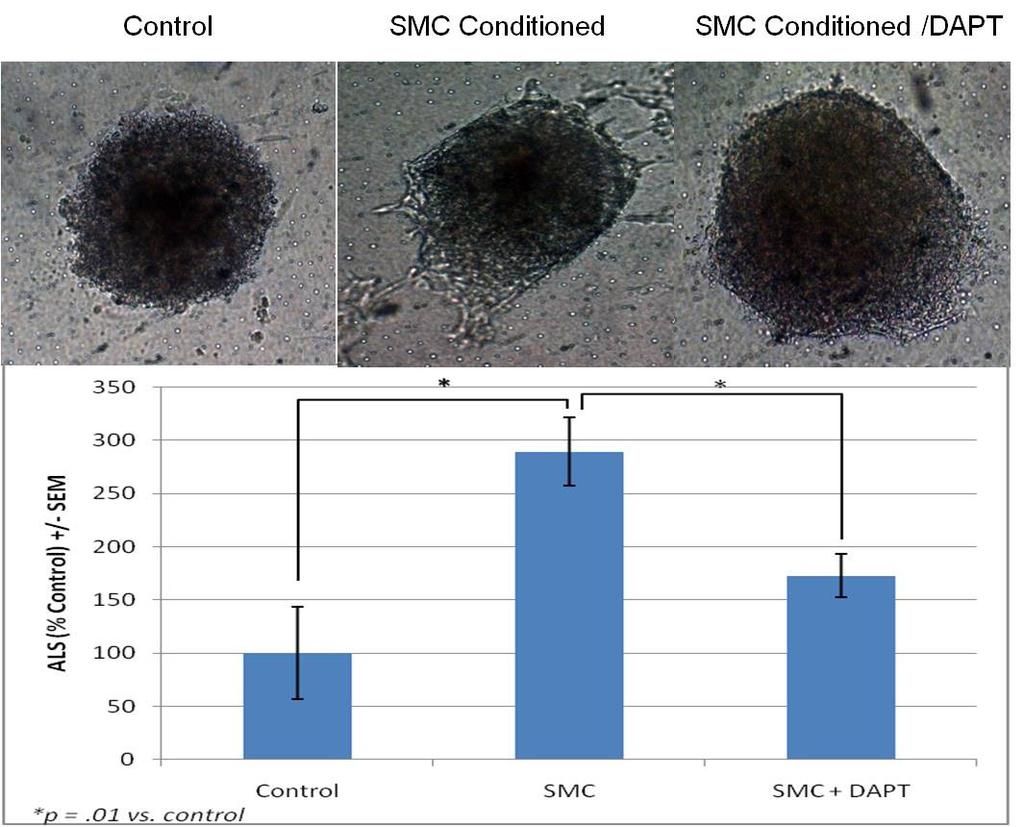 103 The effect of EC Notch inhibition with DAPT on the angiogenic response to SMC-conditioned media was determined.