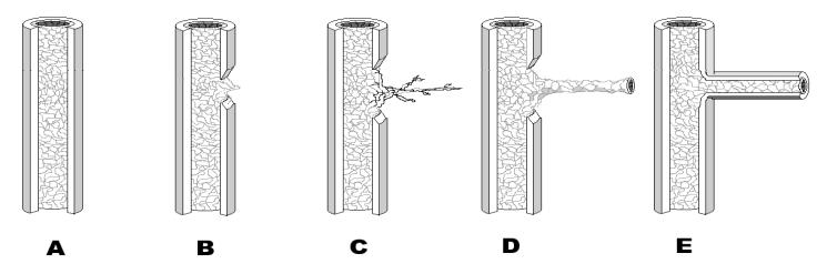 fundamental strategies utilized in tissue engineering in order to optimize microvascular development (Figure 3). 19 Figure 3. Diagrammatic description of the steps involved in angiogenesis.