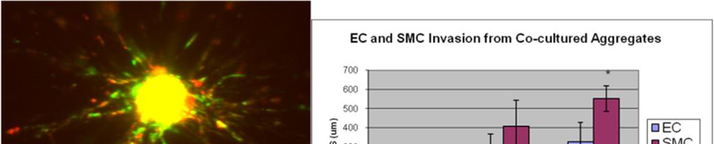 55 significantly differ at Day 13 (564 +/- 79 µm for SMCs versus 378 +/- 55 µm for ECs; p=.23).