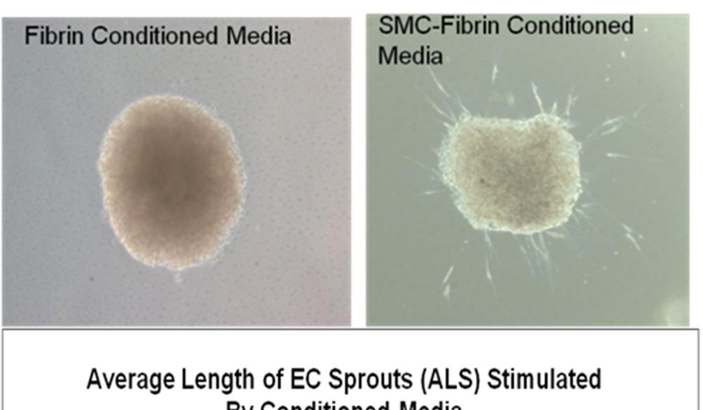 77 Figure 29. SMC-conditioned media induces angiogenesis. EC cultured in unconditioned media (top left) vs. SMC-conditioned media (top right).