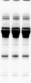 Any kd 1 2 3 4 5 6 7 8 9 1 NuPAGE Gel 1% 4 12% Fig. 4. Superior resolution of a variety of samples.