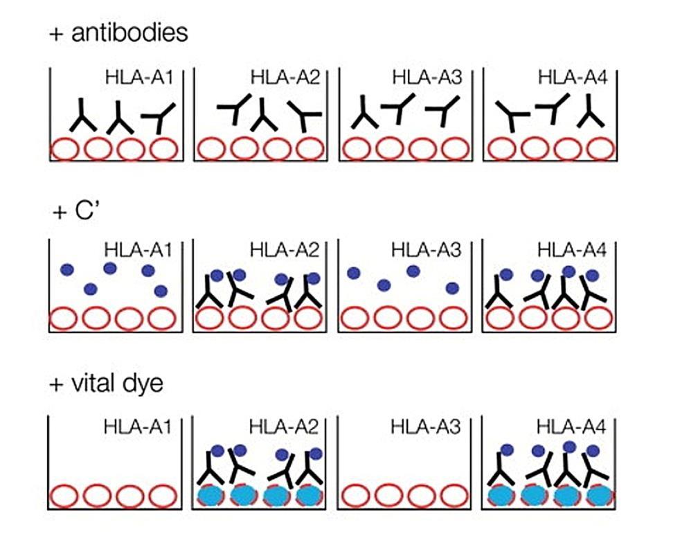 HLA antibody