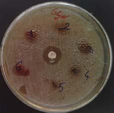 CaA sample and 4,5,6 CuFe 2 O 4 - CaA sample; Pseudomonas Aeroginosa (c) and Escherichia Coli (d)