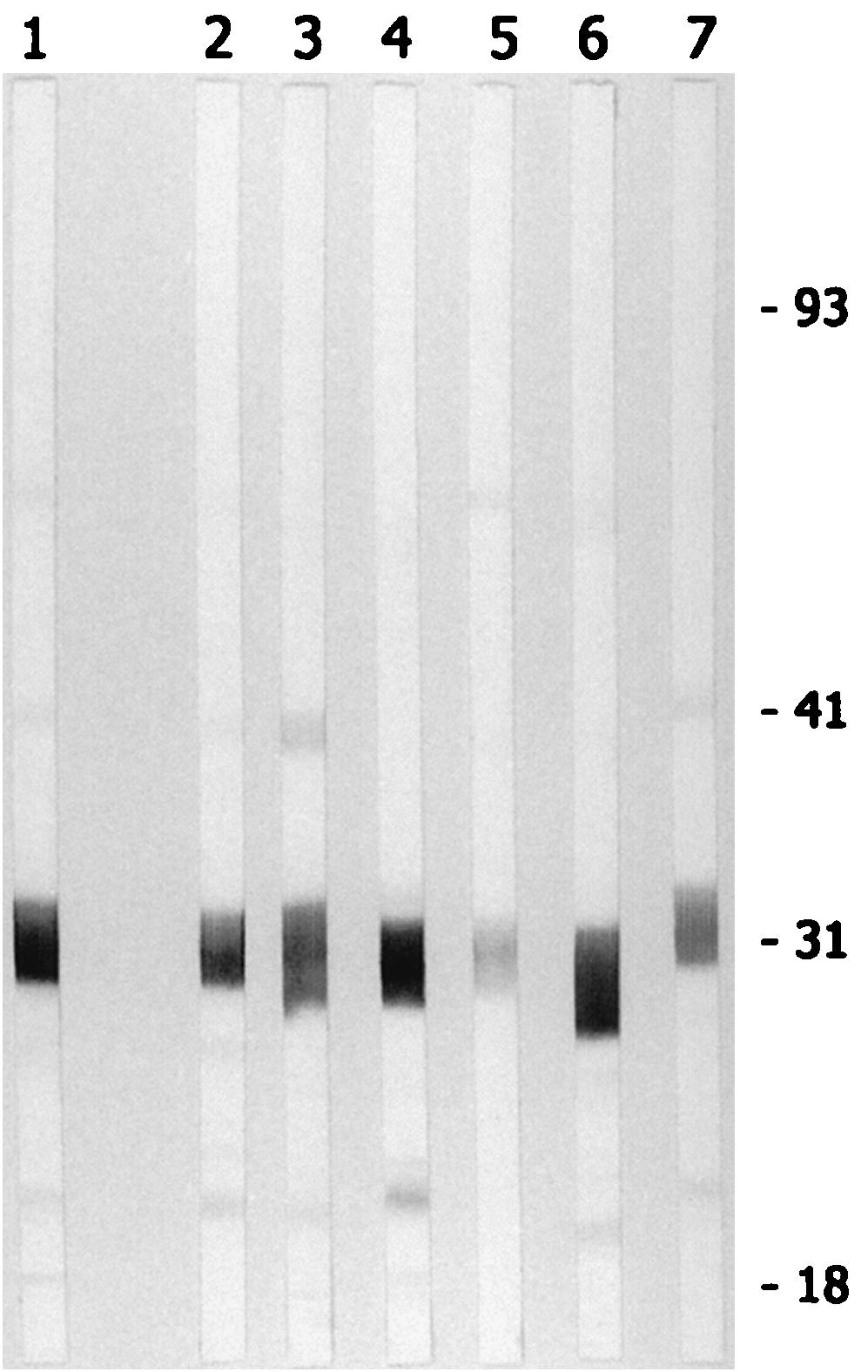 Selected dot blot test strips for detection of IgG antibodies from a B. burgdorferi-infected mouse (Bb) and three mice which received two doses of OspA vaccine (M1 to M3) are shown.