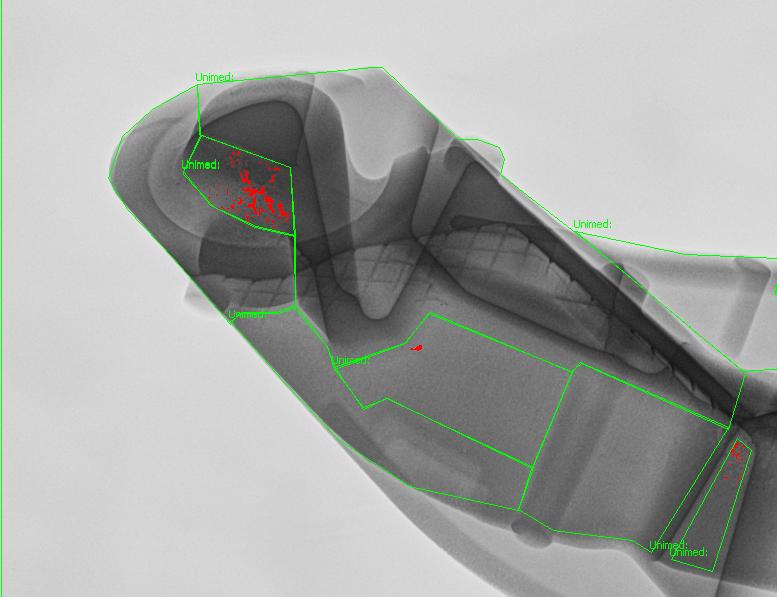 Filters TM optimized Conventional radiography Semi-ADR feature See more with Flash!