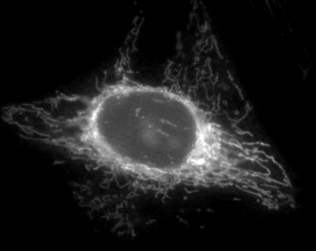 Fluroescence microscopy of TMRE labeled mitochondria in live cells. A.