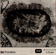 5. Rickecsias -ny oval to rod- shaped bacteria; just visible with light microscope See figure 11.