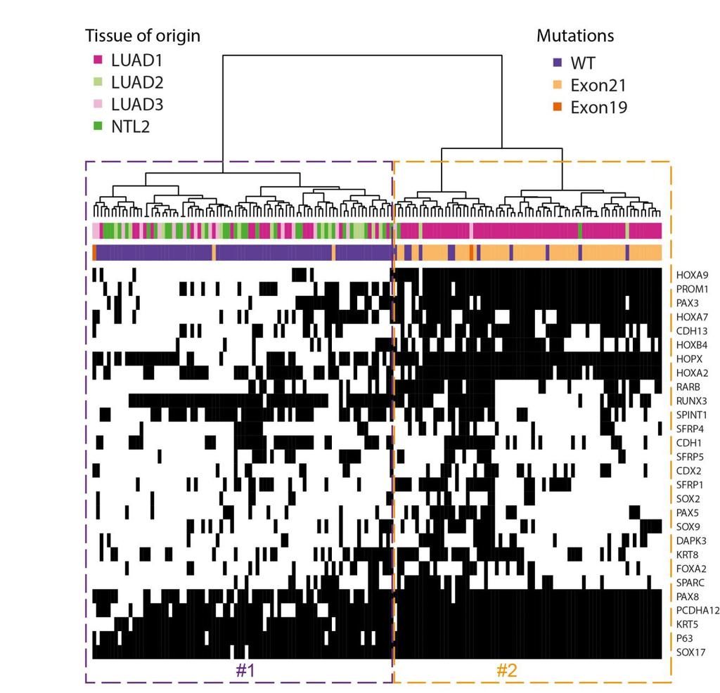 Supplementary Figure 10 Single cell combined genotype and DNA methylation profiling reveals tumor-specific patterns of DNA methylation.