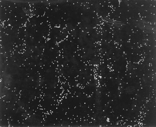 4 BF micrograph of as-cast SC661 alloy, EDS spectra from Si containing particles and (c) microdiffraction pattern of Si containing particles. X-ray mapped image of Si, respectively.