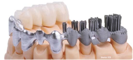 Additive manufacturing will replace conventional production methods for dental crowns/bridges and customized implants AM for customized medical products DENTAL CROWNS/BRIDGES Source: EOS IMPLANTS