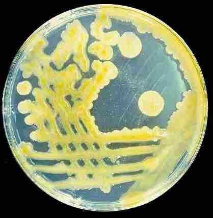 Microorganisms (Archea, Bacteria, Fungi) Haloferax