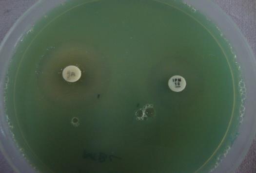 aeruginosa isolates to routinely tested antibiotics based on Kirby Bauer s disc diffusion method is depicted in Table 2.