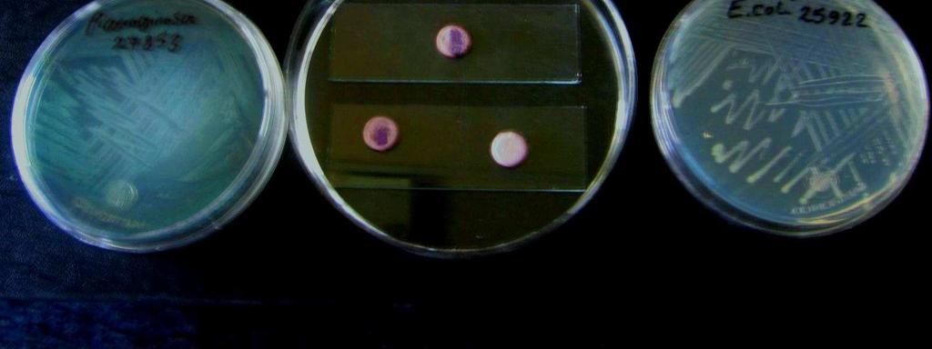 Conclusion In the present research, 00 isolates of pseudomonas aeruginosa strains after doing standard microbiological laboratory tests were collected (image -3).