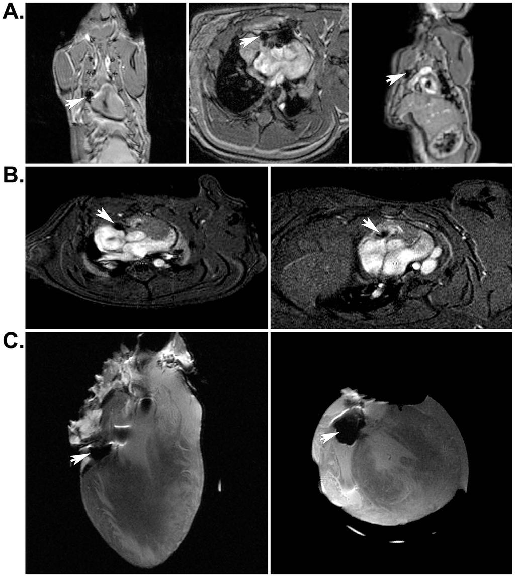 Figure 2. Localization of SPIO-labeled cells in implanted rat hearts by MRI.