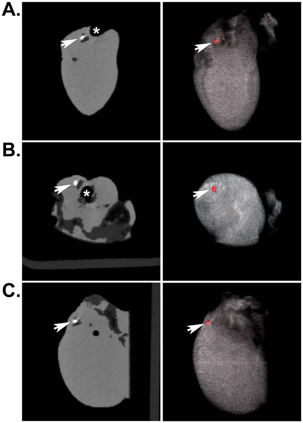 Figure 4. Localization of SPIO-labeled cells in excised hearts by mct.