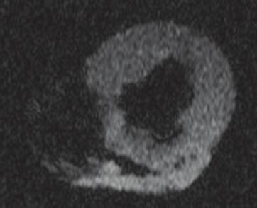 (a5) (b5) (a5) (b5) Figure 5: MRI images of porcine