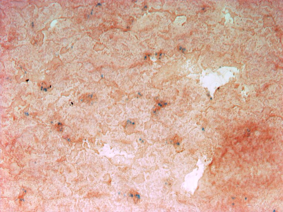 50 µm Figure 11. Iron and macrophage double staining in frozen liver tissue sections from chickens injected intravenously with iron oxide (IO) nanoparticles.