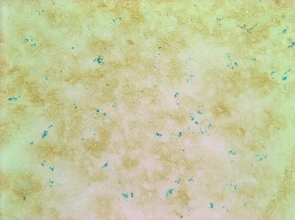 50 µm Figure 13. Iron oxide and isotype control double staining in frozen liver tissue sections from chickens injected intravenously with iron oxide nanoparticles.