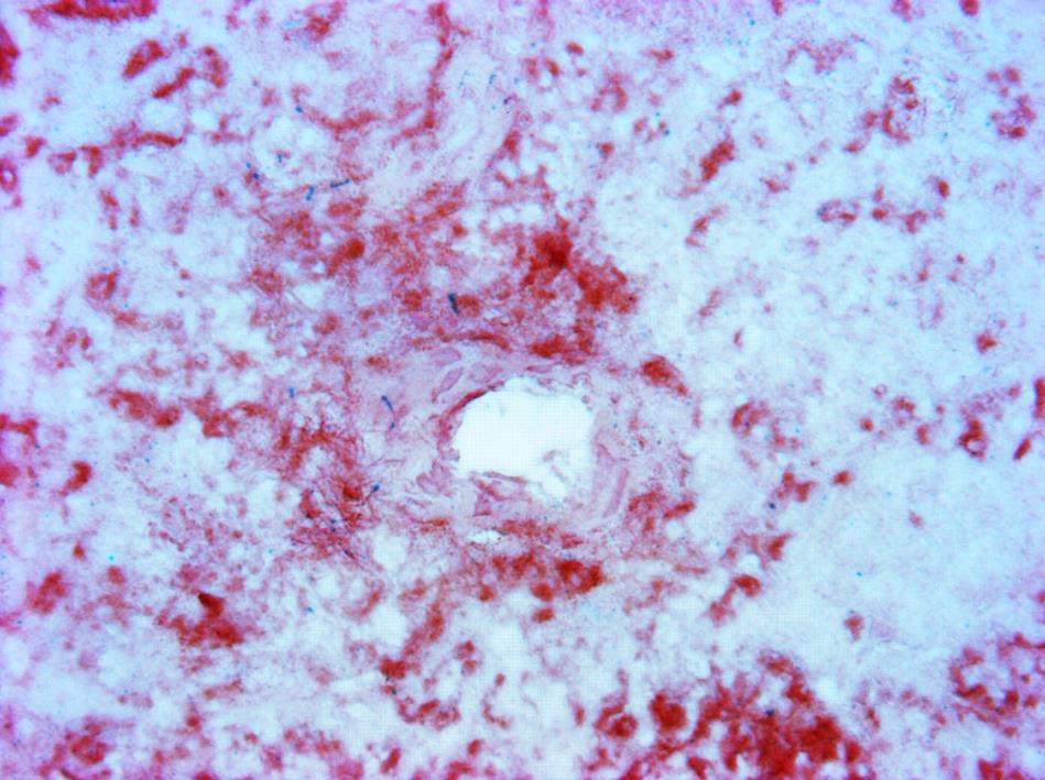 50 µm Figure 14. Iron oxide and macrophage double staining in frozen spleen tissue sections from chickens injected intravenously with iron oxide nanoparticles.
