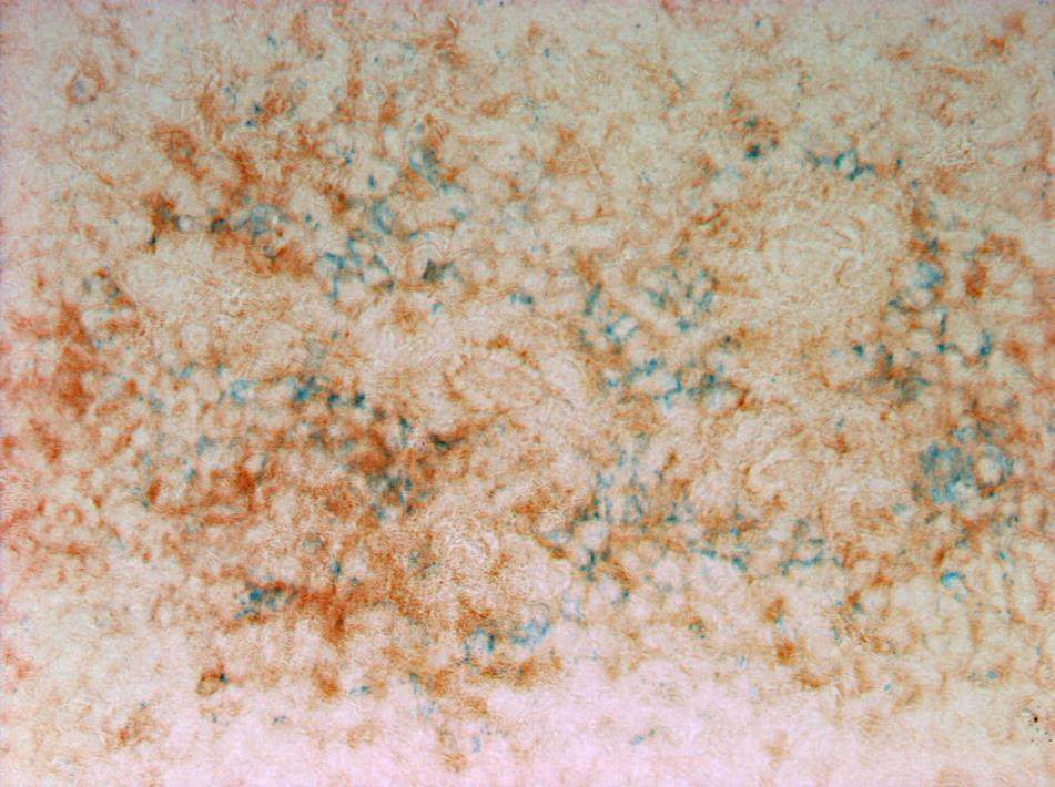 50 µm Figure 15. Iron oxide and MHC class II double staining in frozen spleen tissue sections from chickens injected intravenously with iron oxide nanoparticles.