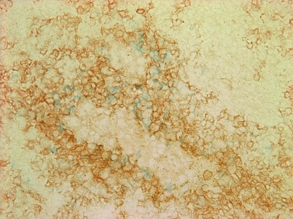 50 µm Figure 16. Iron oxide and Bu-1 (B cells) double staining in frozen spleen tissue sections from chickens injected intravenously with iron oxide nanoparticles.