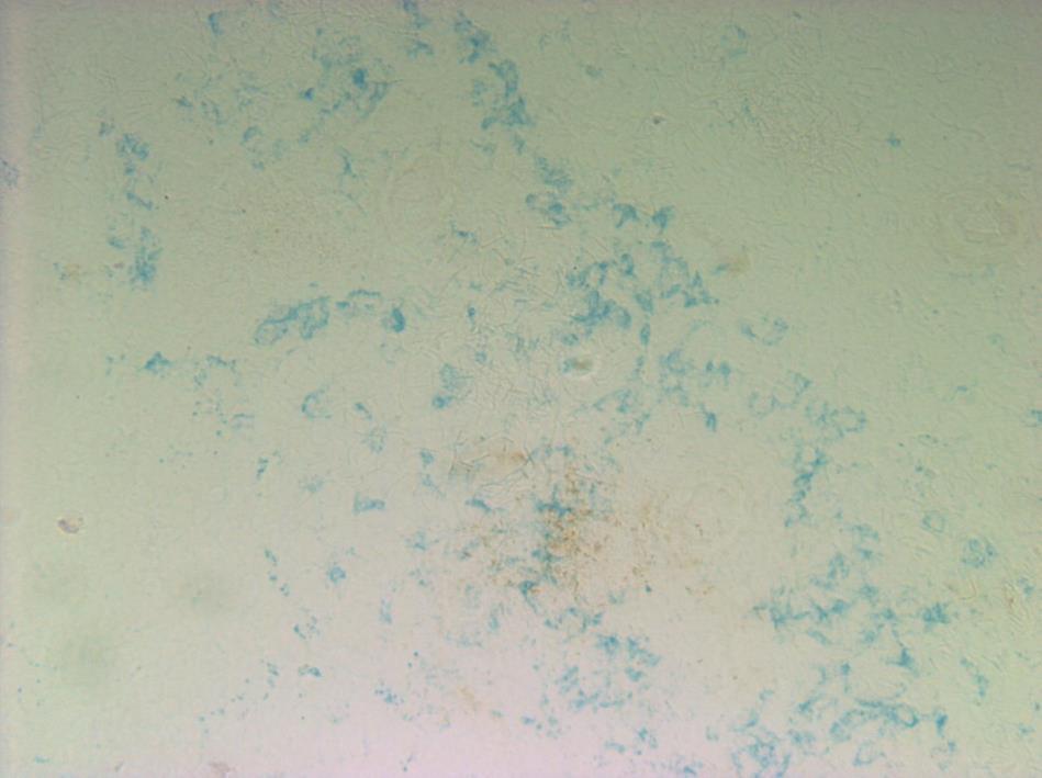 50 µm Figure 17. Iron oxide and isotype control double staining in frozen spleen tissue sections from chickens injected intravenously with iron oxide nanoparticles.