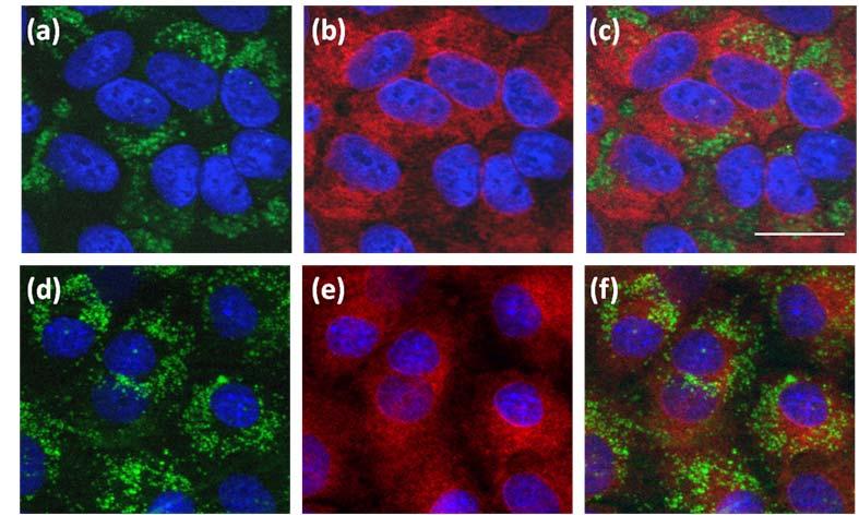 3.4. Results 109 Figure 3.12: Nanoparticles subcellular localisation using an endoplasmic reticulum marker (Anti-Derlin Ab). Cells were treated with fluorescein-labelled R8 nanoparticles at 0.