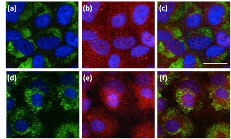 The higher panel is OK cells with fluorescein-labelled R8 in green and DAPI in blue (a), Anti-Derlin Ab in red and DAPI in blue (b), and the merge image (c).