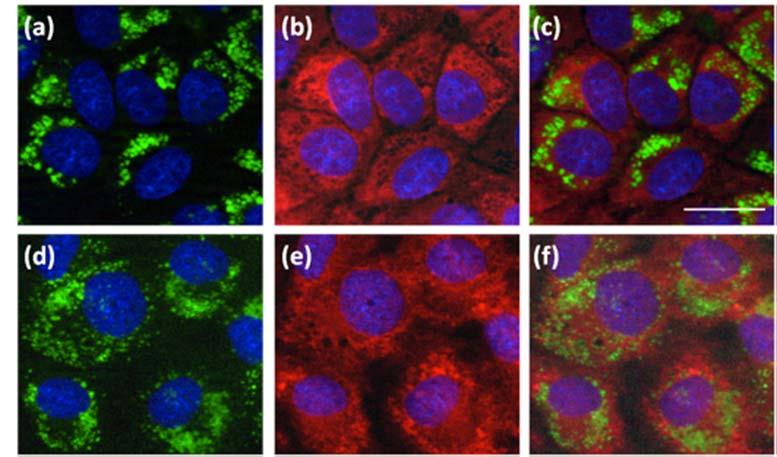 110 Chapter 3. Nano-bio interface studies Figure 3.14: Nanoparticles subcellular localisation using MitoTracker Red CMXRos. Cells were treated with fluorescein-labelled R8 nanoparticles at 0.