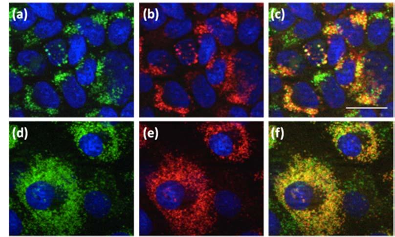 The higher panel is OK cells with fluoresceinlabelled R8in green and DAPI in blue (a), MitoTracker in red and DAPI in blue (b), and the merge image (c).