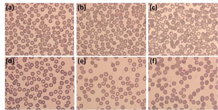 158 Chapter 4 Haemocompatibility studies Figure 4.20: The effect of DMSA-PEG-(NH 2 ) 2 bioferrofluids on: (a) Erythrocytes, (b) Leukocytes, (c) Platelets, (d) Haemoglobin and (e) Haematocrit.
