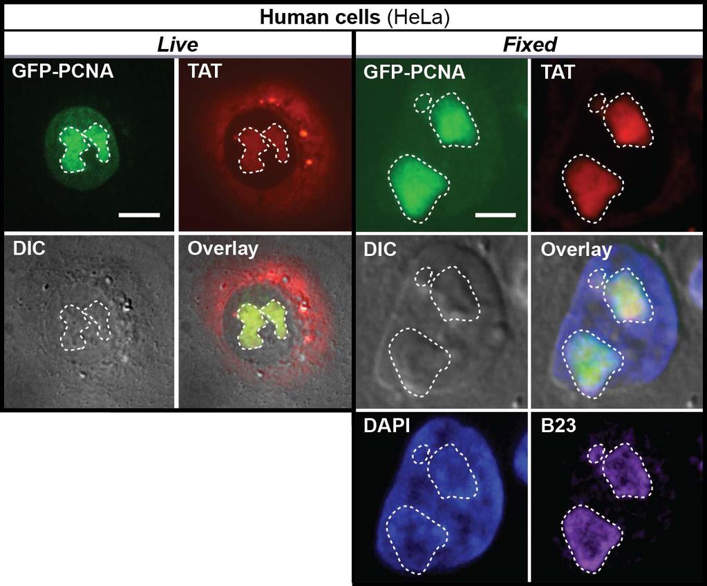 1.11 The cell-permeable nanobody recruits GFP tagged PCNA to the nucleolus as shown by a live-cell nucleolar staining and by immunostaining in fixed cells Supplementary Figure 12 Redistribution of