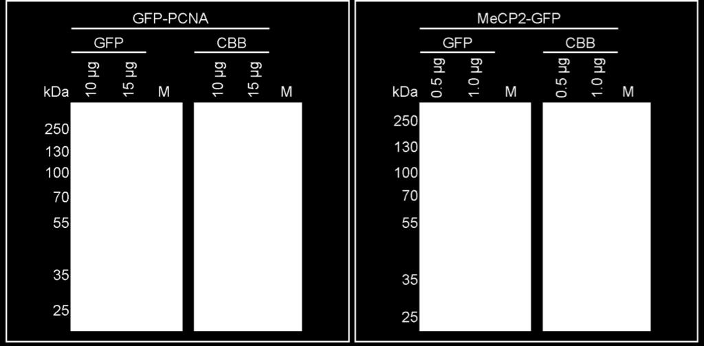 Purified Mecp2-GFP runs at the height of 110 kda (predicted size of 83 kda).